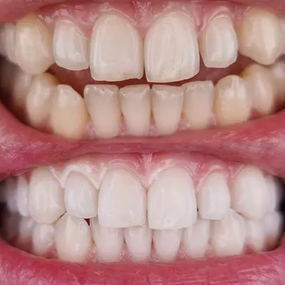 Bednarz Stomatologia || Implanty zębów || Chirurg Stomatolog